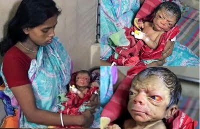 Indian Woman Gives Birth to Old Baby Magura